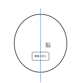 半分になっちゃった思考実験 - 意識の複製はできるのか、主観とは何か:画像6