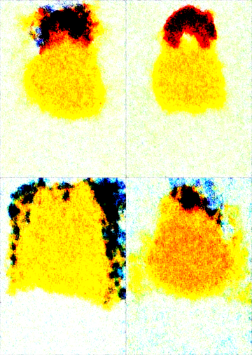 Stable Diffusionの新しいモデルで画像生成するとノイズ画像が生成され、画像が生成できない (V-Prediction モデルの利用):画像1